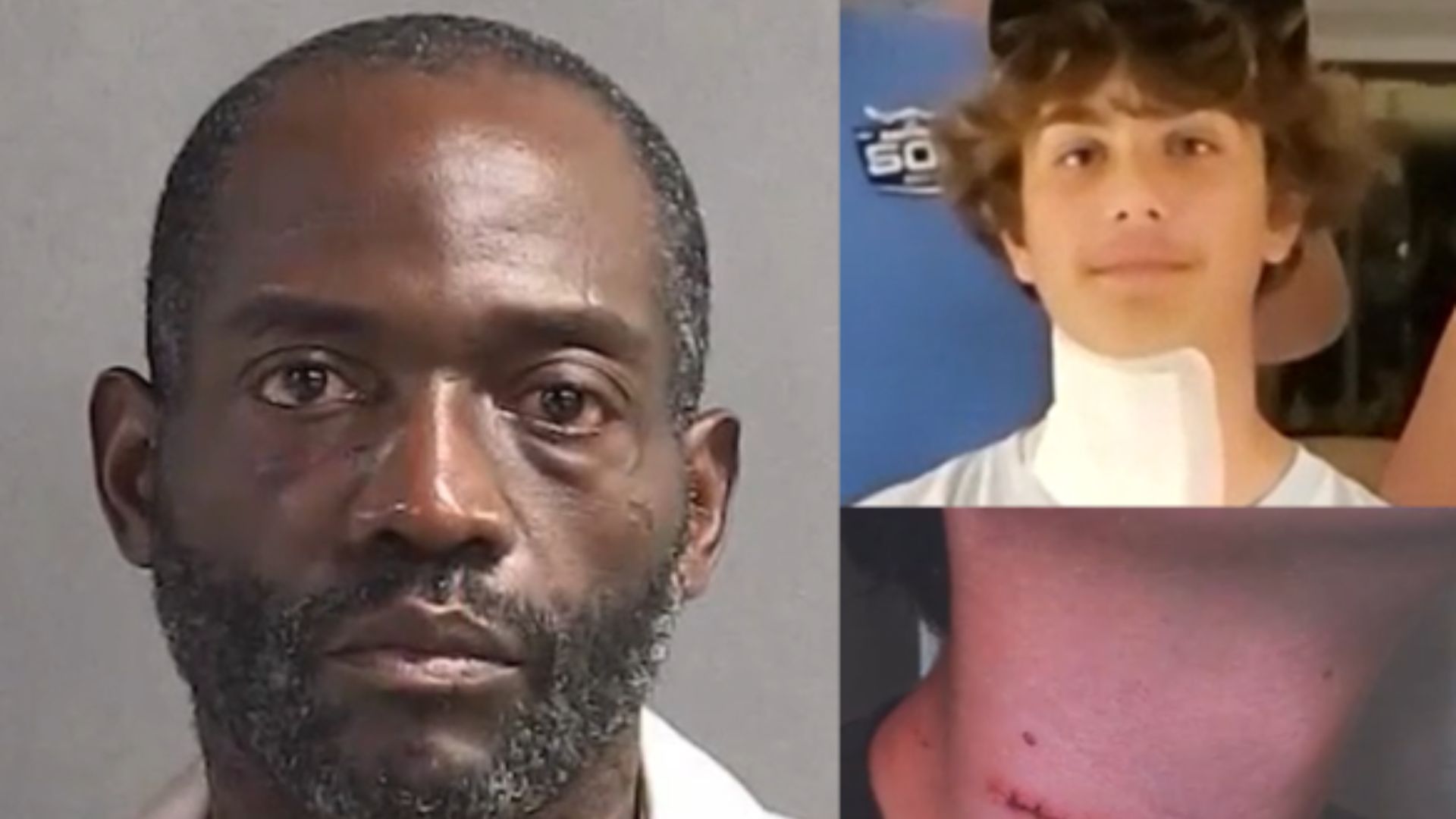 teen-stabbed-4884